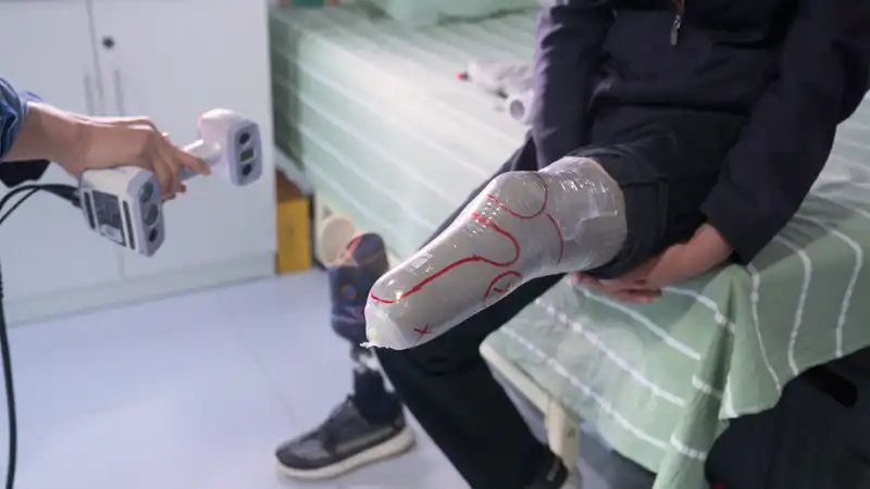 Digitalização para criação de próteses com o EinScan H2